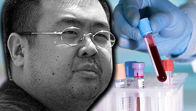jong-nam-dna-test