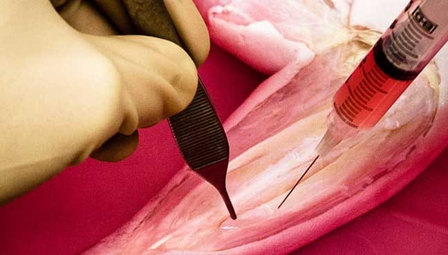 Human-muscle-tissue-grown-from-stem-cells