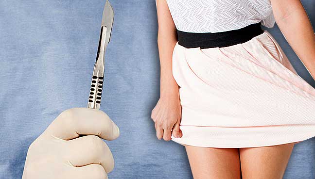 Rush for ‘Barbie’ vagina has experts stumped