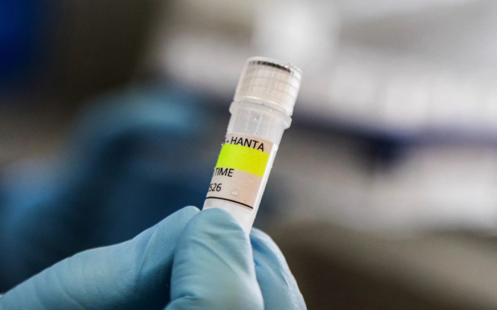 This handout picture released by Argentina's Health Ministry shows a scientist from the Malbrán Institute holding a container used to diagnose the Andes hantavirus, which contains RNA from the Andes virus as part of the detection process, in Buenos Aires on May 6, 2026. Argentina has seen an increase in hantavirus cases but not an outbreak, an expert told AFP on May 6, as infections aboard a cruise ship have provoked a global health scare. The MV Hondius set sail from Ushuaia in southern Argentina on April 1 and is currently anchored off the coast of Cape Verde after three passengers died, possibly of hantavirus.