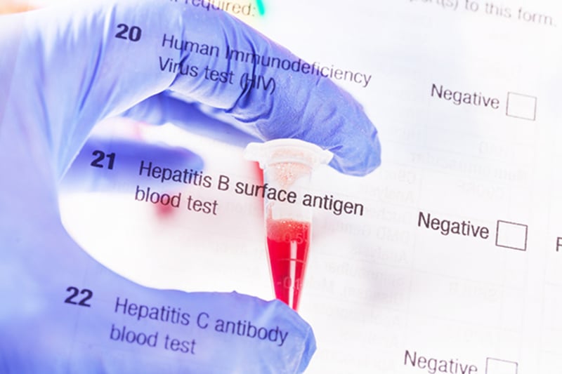 Push to cure hepatitis B, a neglected disease