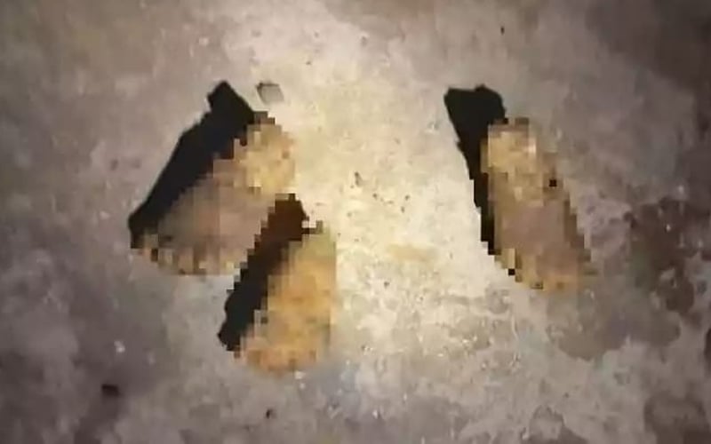 3 cebisan kaki kanak-kanak ditemui digonggong anjing