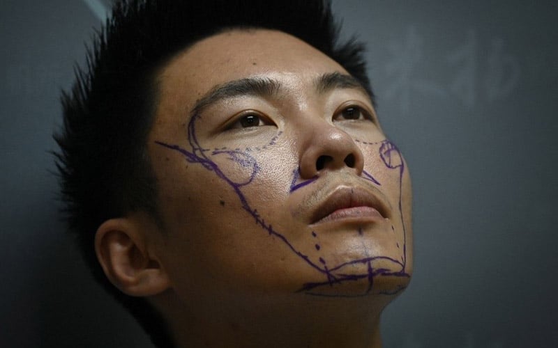 China’s men go under the knife to change their fate
