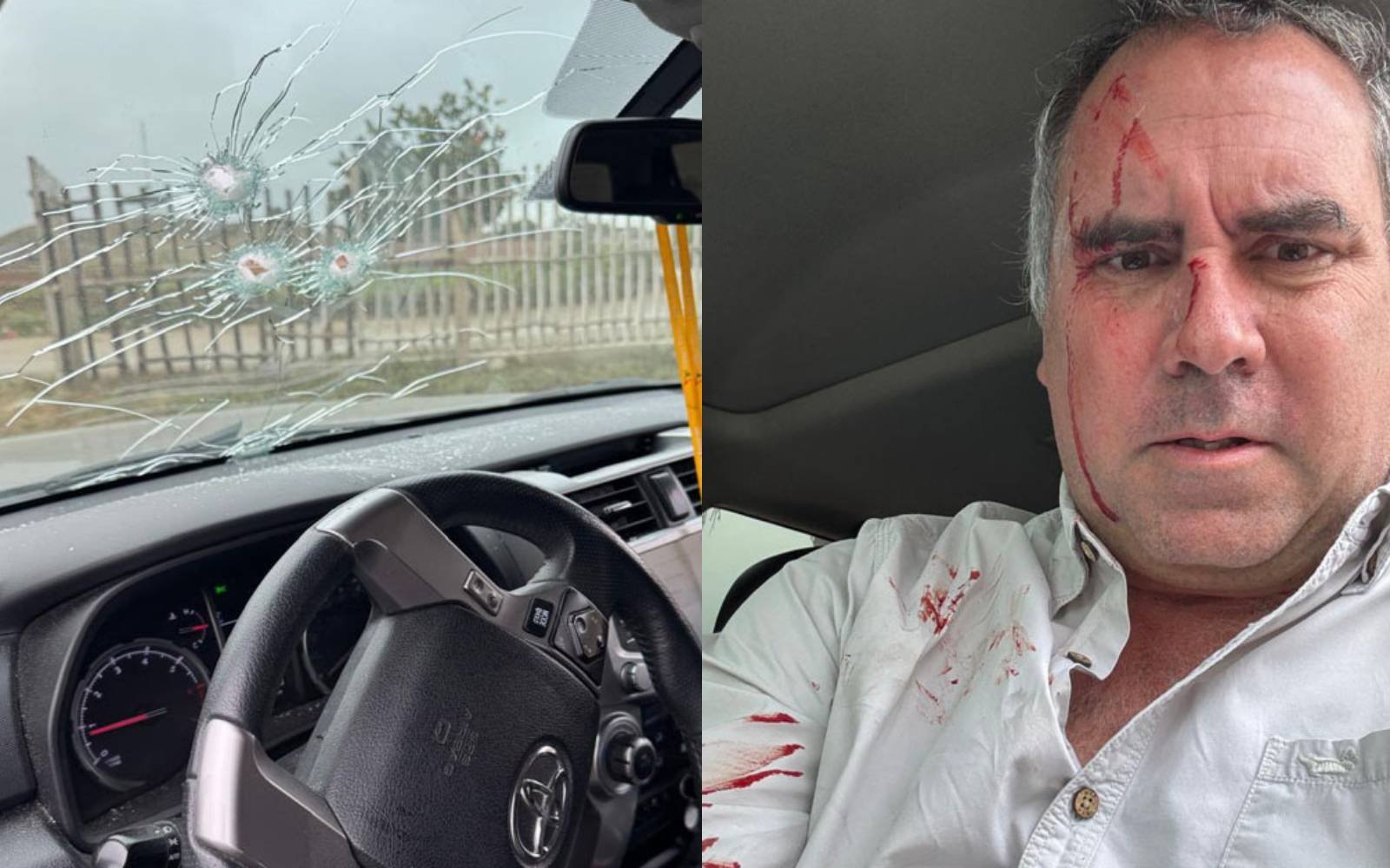 Peru’s presidential hopeful bloodied but safe after gun attack