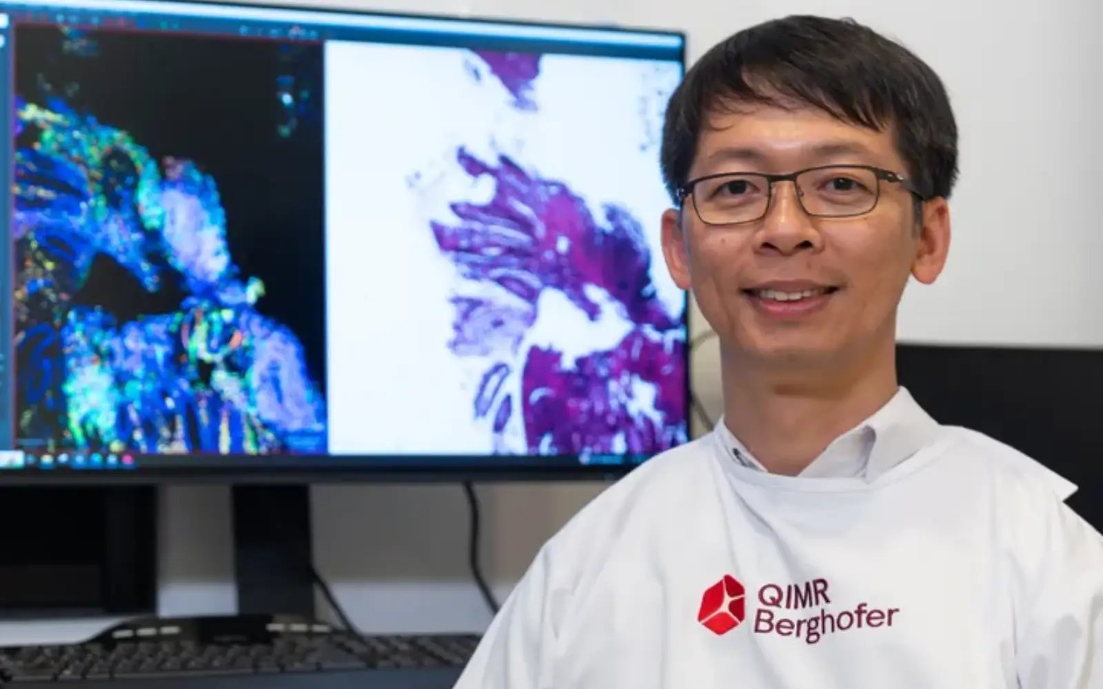 AI tool gives pathologists ‘super vision’ to detect hidden cancers